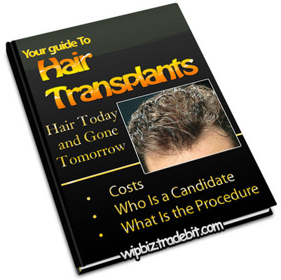 Product picture Your Guide to Hair Transplant  (Hair Today and Gone Tomorrow)
