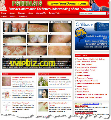 Product picture Psoriasis Website PLR - Turnkey WordPress Blogs
